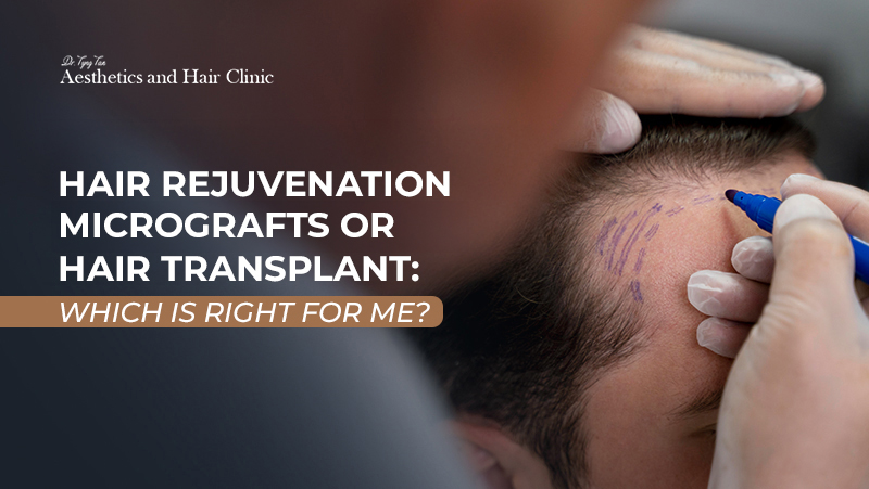 hair rejuvenation micrografts singapore dr tyng tan